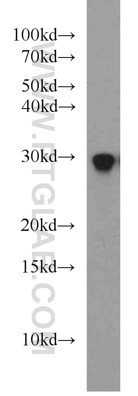 WB analysis of mouse skin using 55295-1-AP