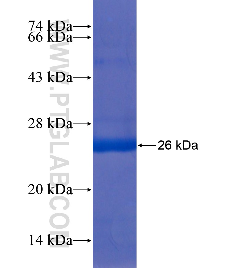 RAB8B fusion protein Ag17961 SDS-PAGE RAB8B fusion protein Ag17961 SDS-PAGE