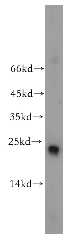 WB analysis of HEK-293 using 18719-1-AP