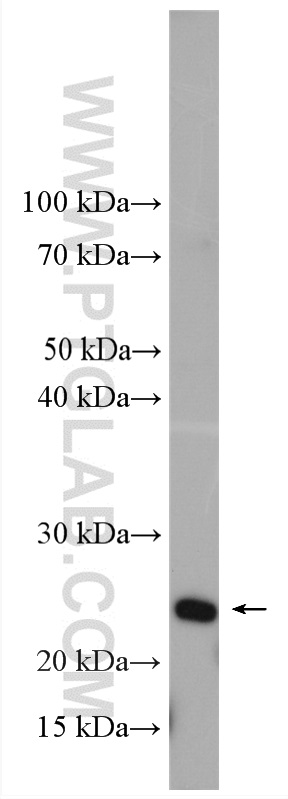 WB analysis of HeLa using 18152-1-AP