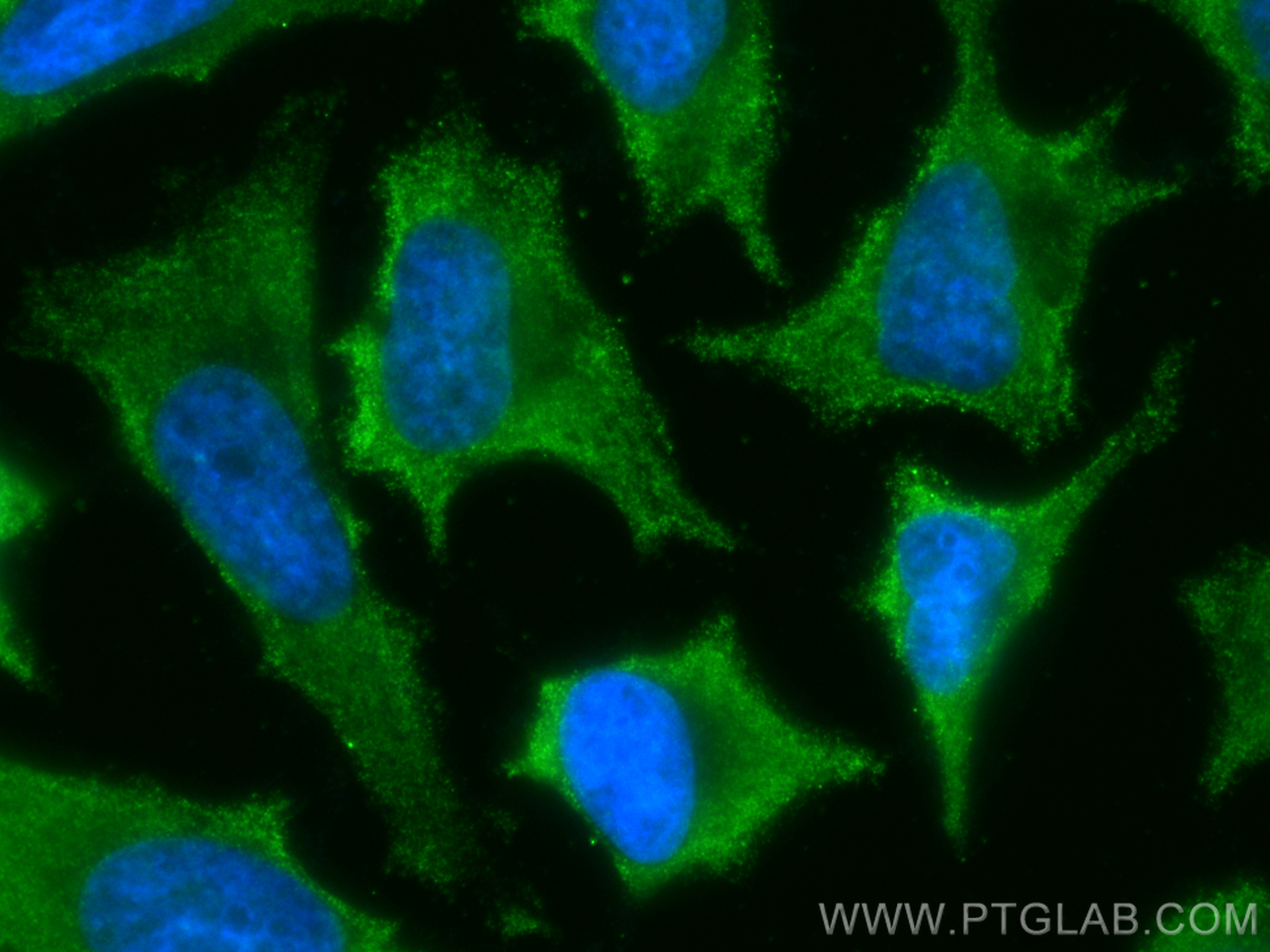 IF Staining of HeLa using CL488-68031