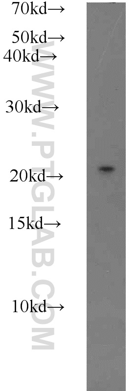 WB analysis of HEK-293 using 10542-1-AP