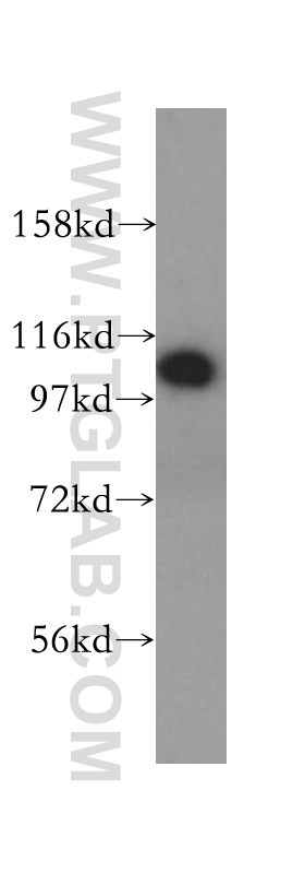 WB analysis of HeLa using 14350-1-AP