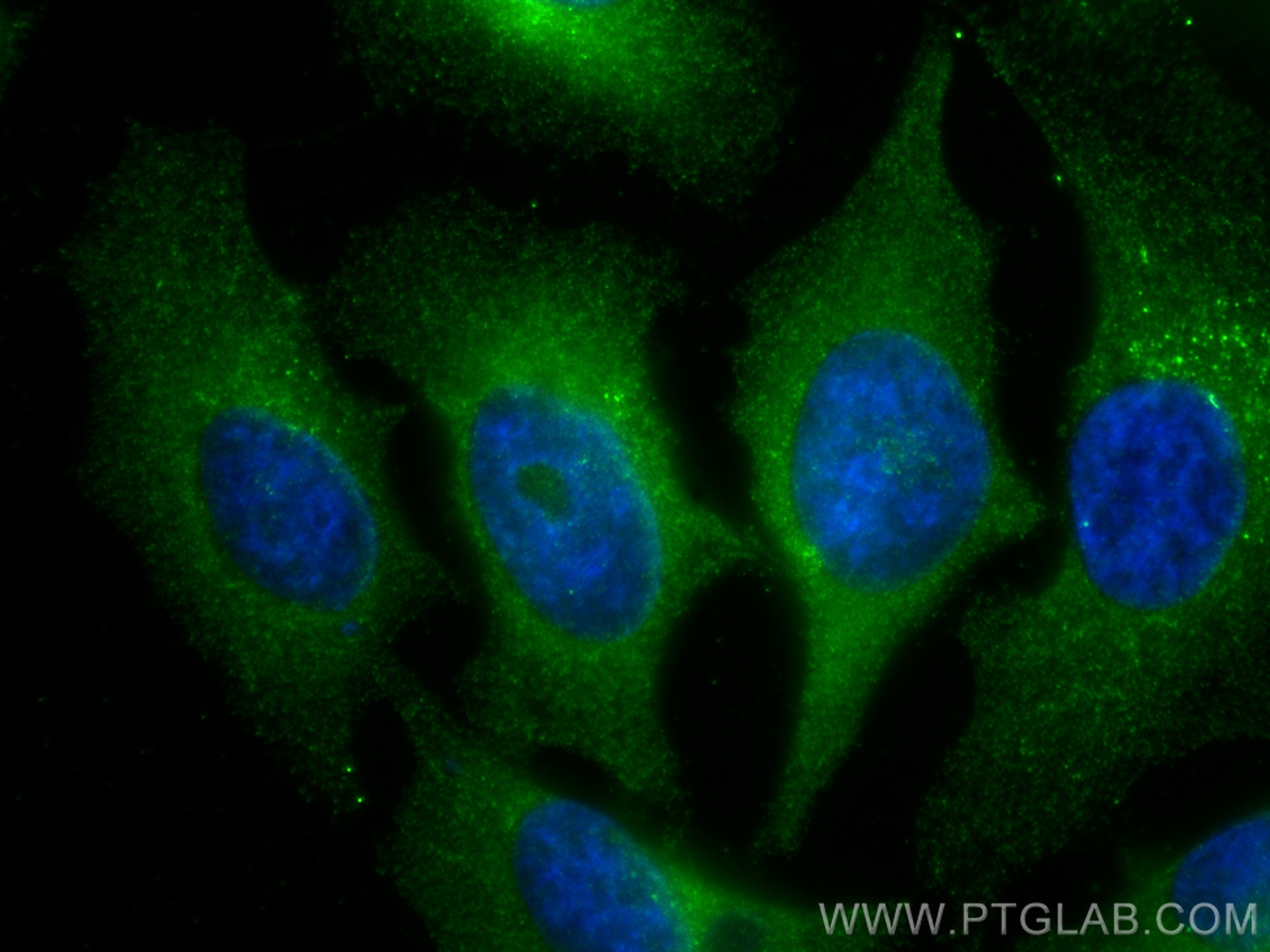 IF Staining of HeLa using 68285-1-Ig (same clone as 68285-1-PBS)