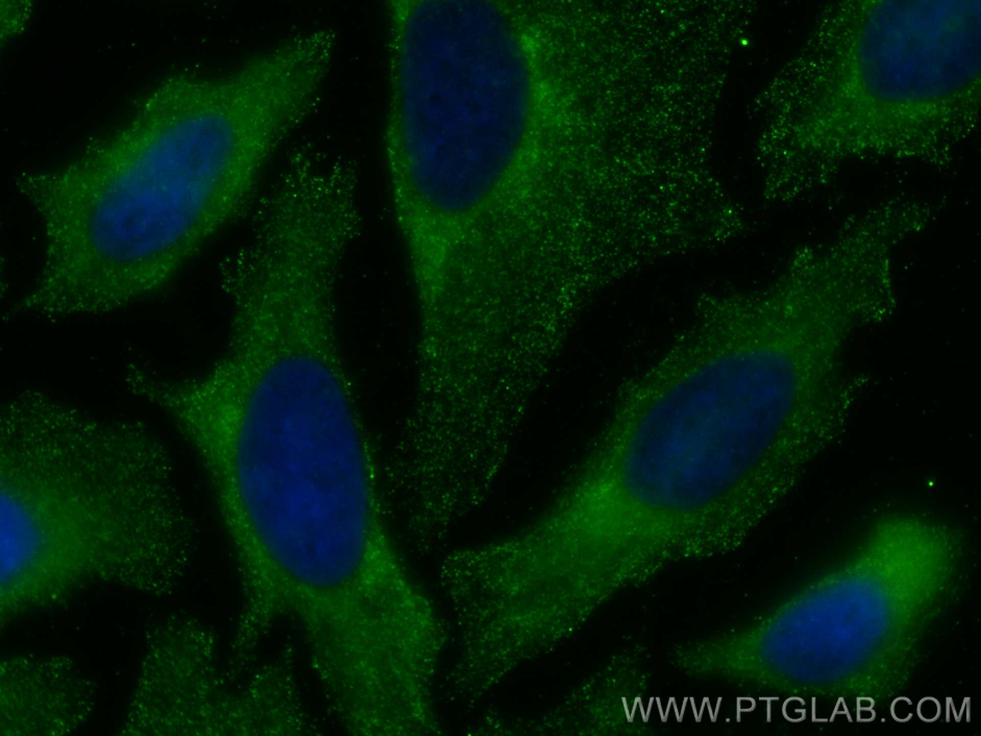 IF Staining of HeLa using 68285-1-Ig (same clone as 68285-1-PBS)