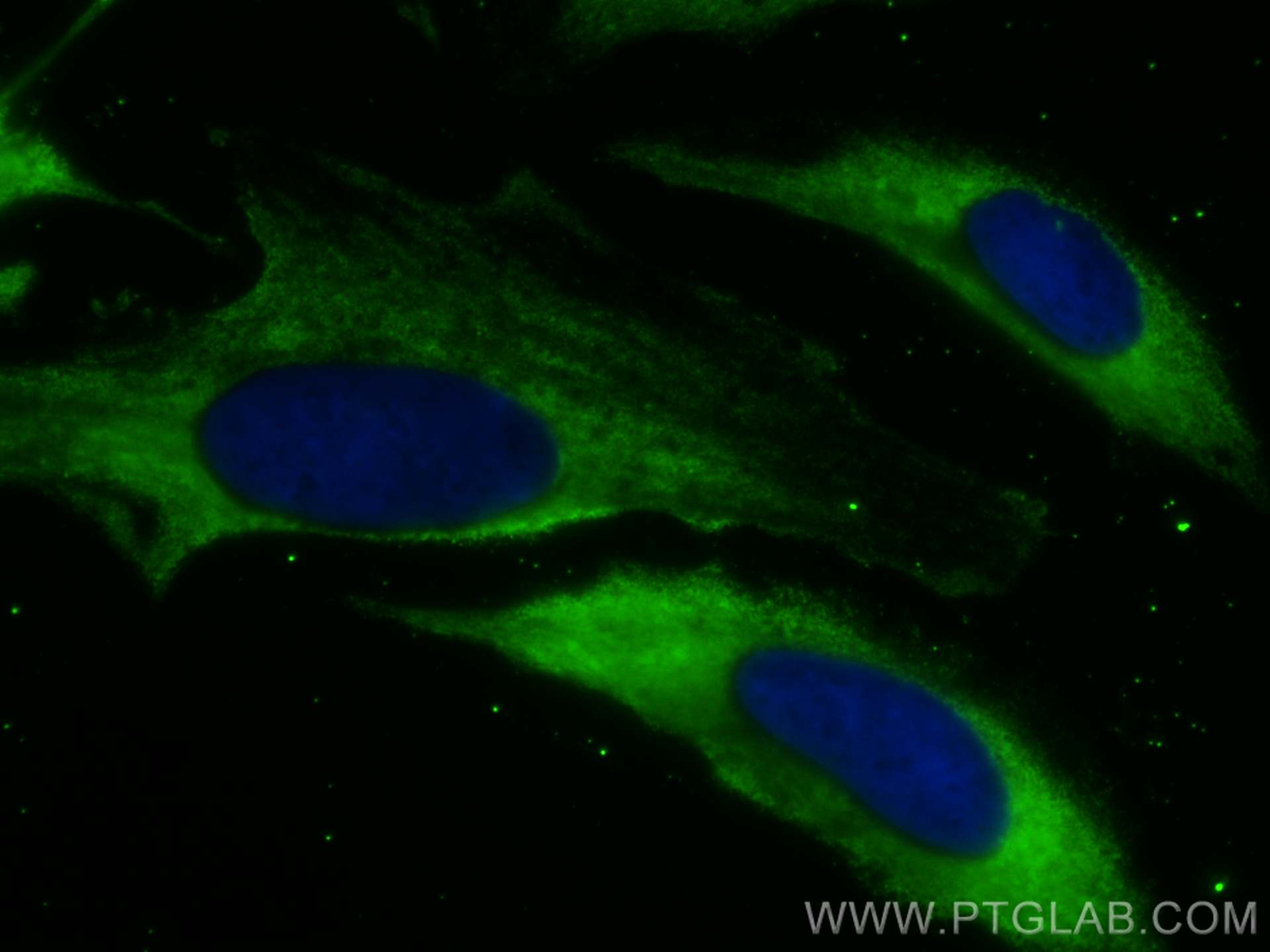 IF Staining of HeLa using CL488-68285