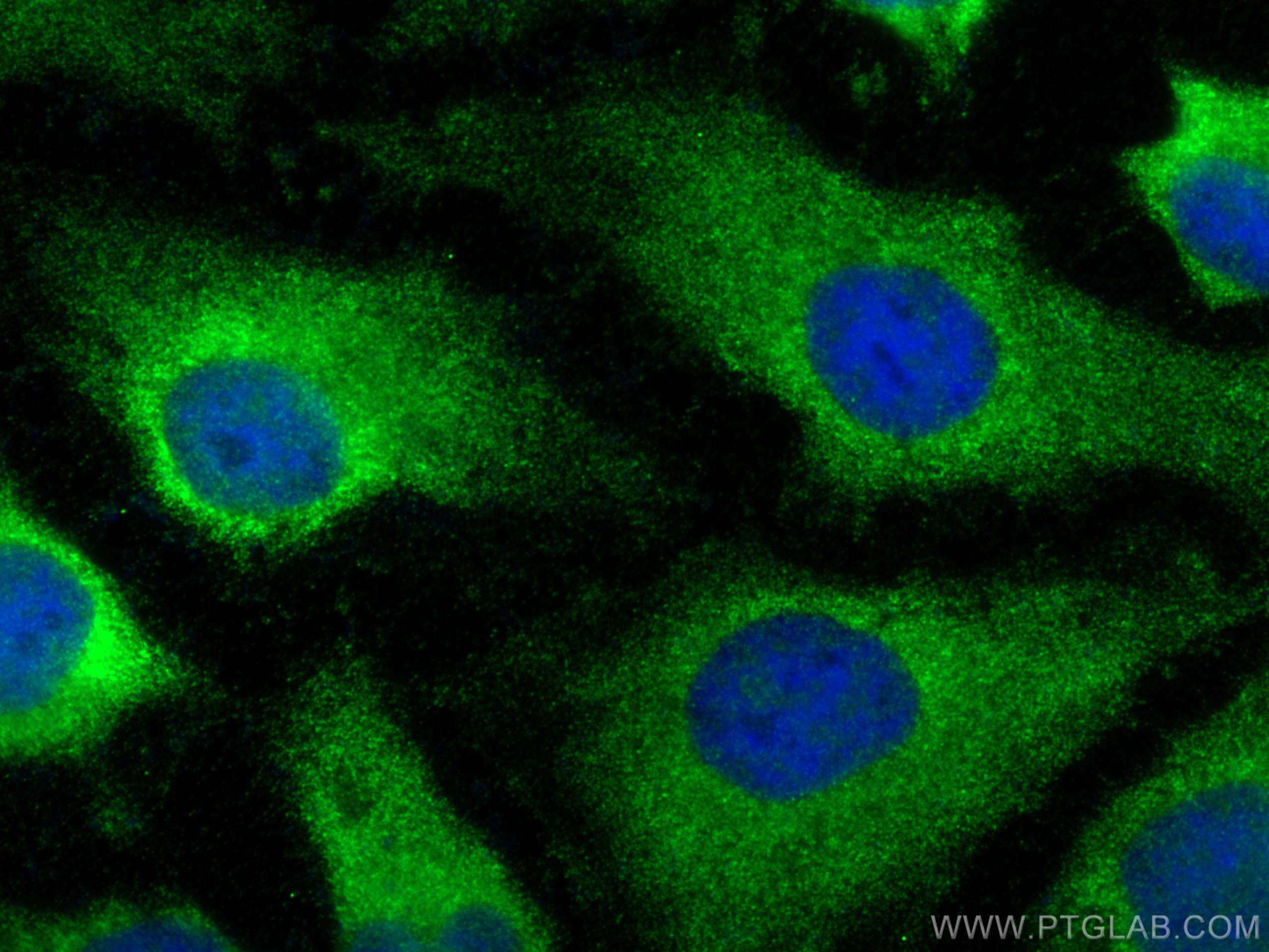 IF Staining of HeLa using 15105-1-AP