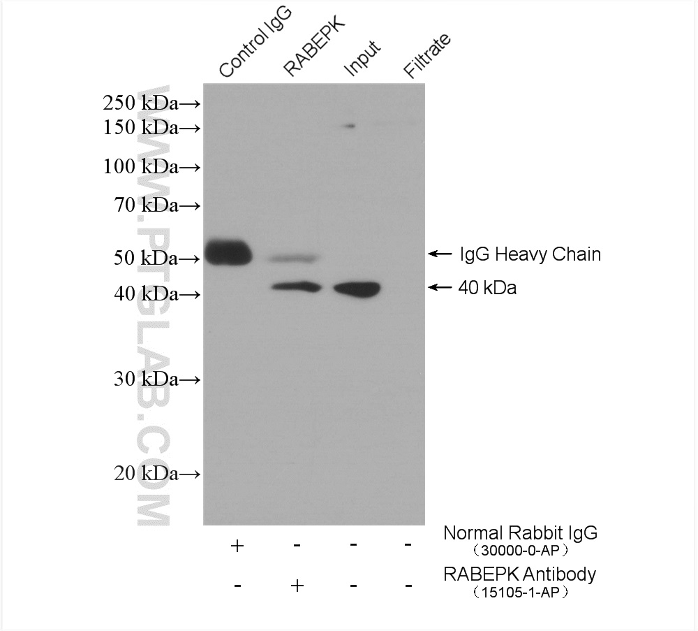 IP experiment of HeLa using 15105-1-AP