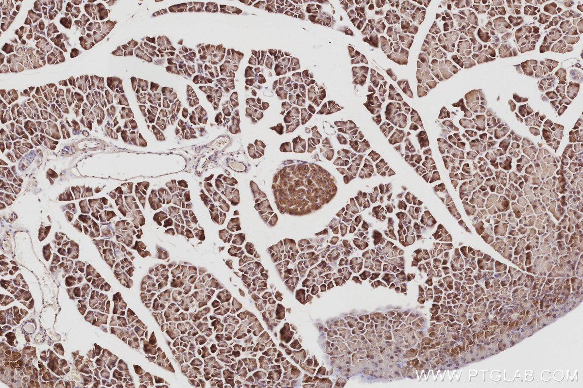 IHC staining of mouse pancreas using 14223-1-AP