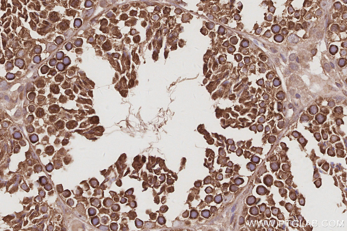 IHC staining of mouse testis using 14223-1-AP