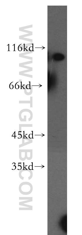 WB analysis of HeLa using 13894-1-AP