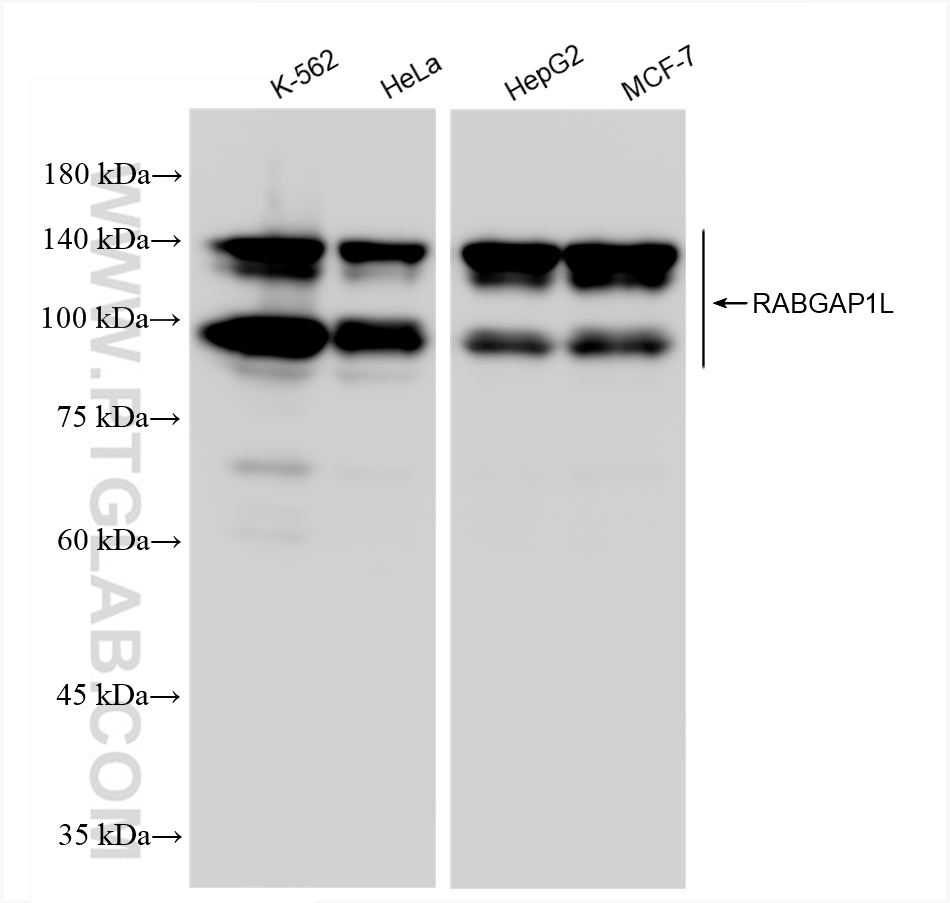 WB analysis using 83698-4-RR (same clone as 83698-4-PBS)