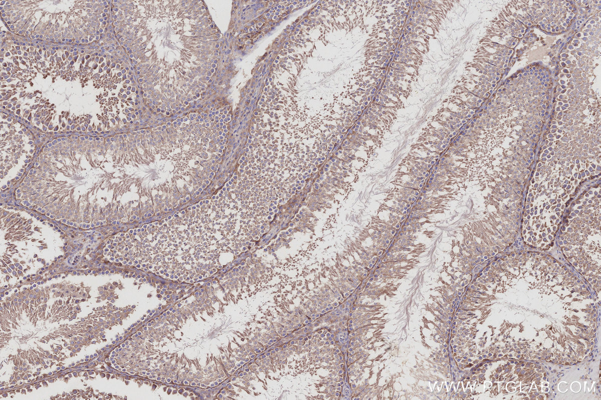 IHC staining of rat testis using 12735-1-AP IHC staining of rat testis using 12735-1-AP