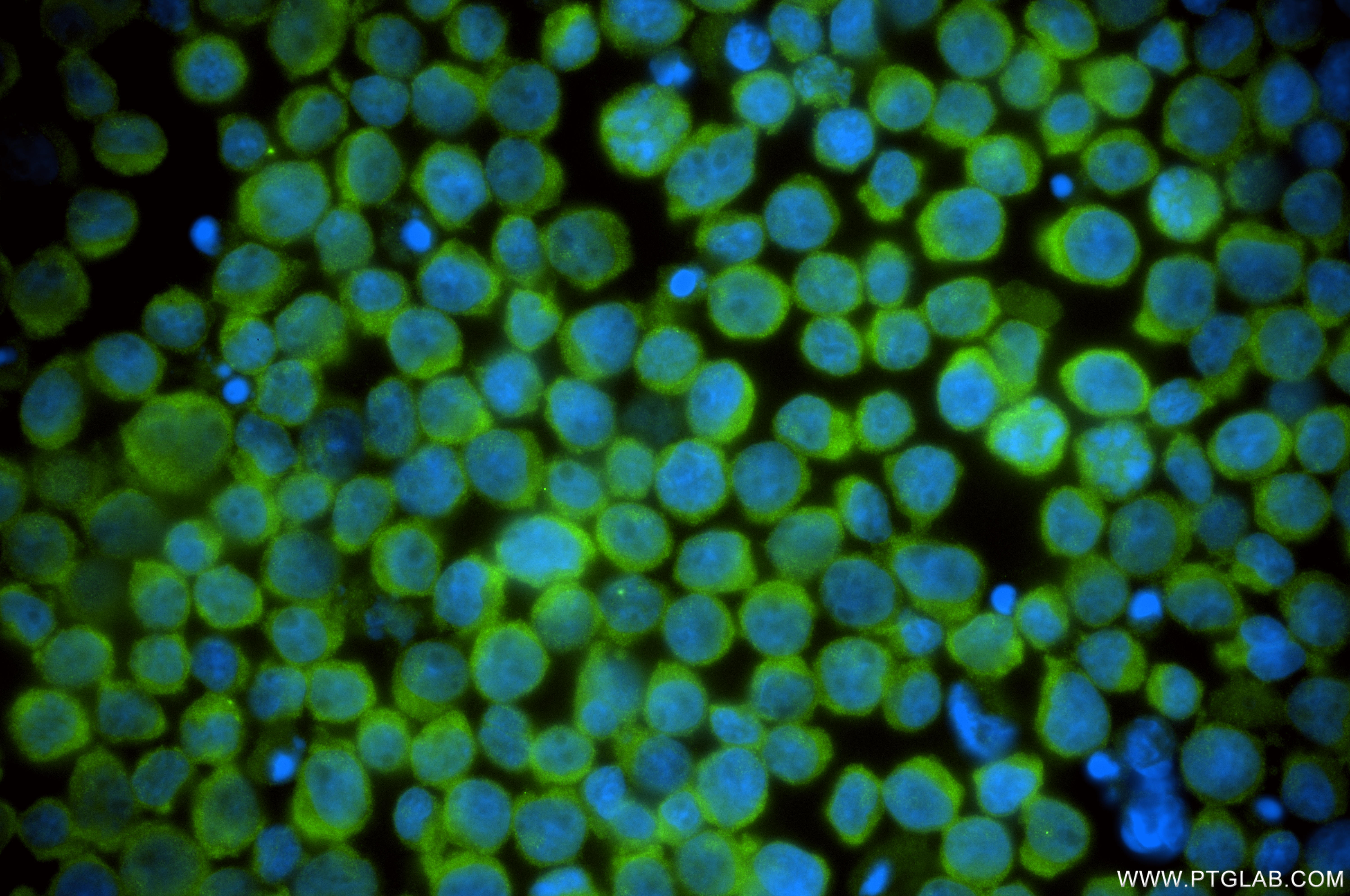 IF Staining of Jurkat using 86386-3-RR IF Staining of Jurkat using 86386-3-RR