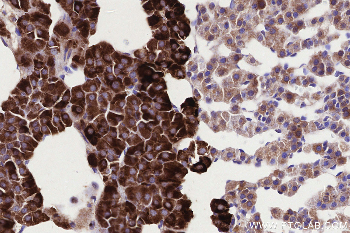 IHC staining of rat adrenal gland using 86386-3-RR IHC staining of rat adrenal gland using 86386-3-RR