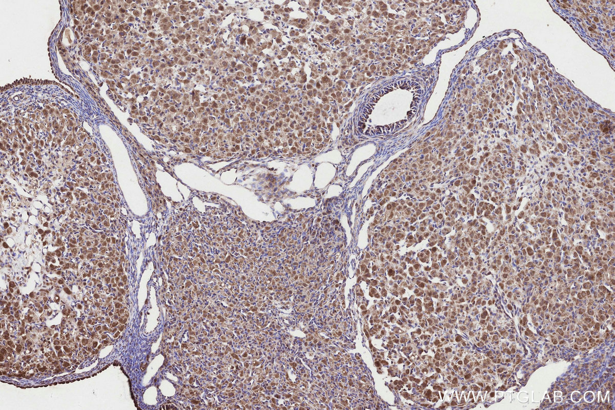 IHC staining of rat ovary using 86386-3-RR IHC staining of rat ovary using 86386-3-RR