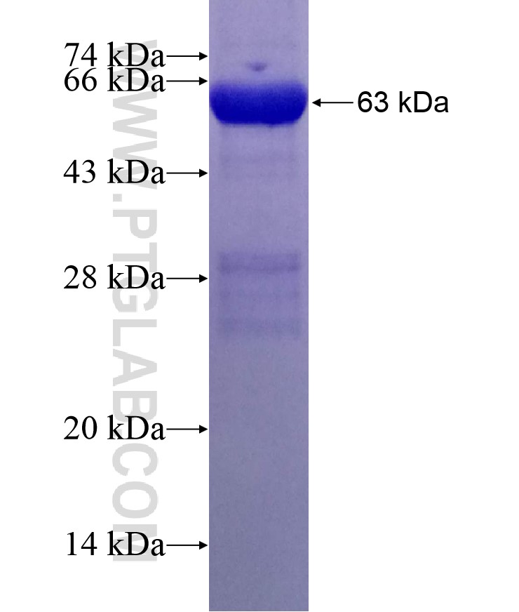 RABGGTB fusion protein Ag2376 SDS-PAGE