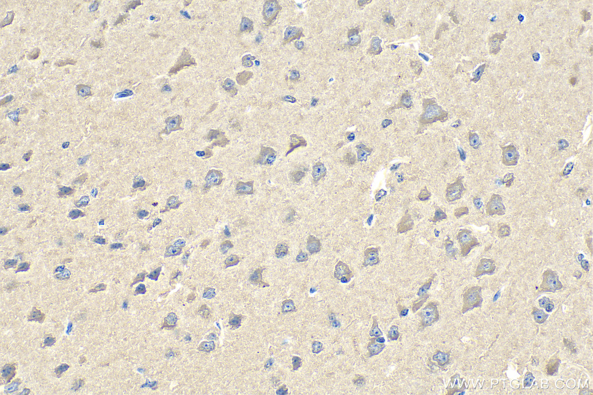 IHC staining of mouse brain using 29113-1-AP (same clone as 29113-1-PBS)
