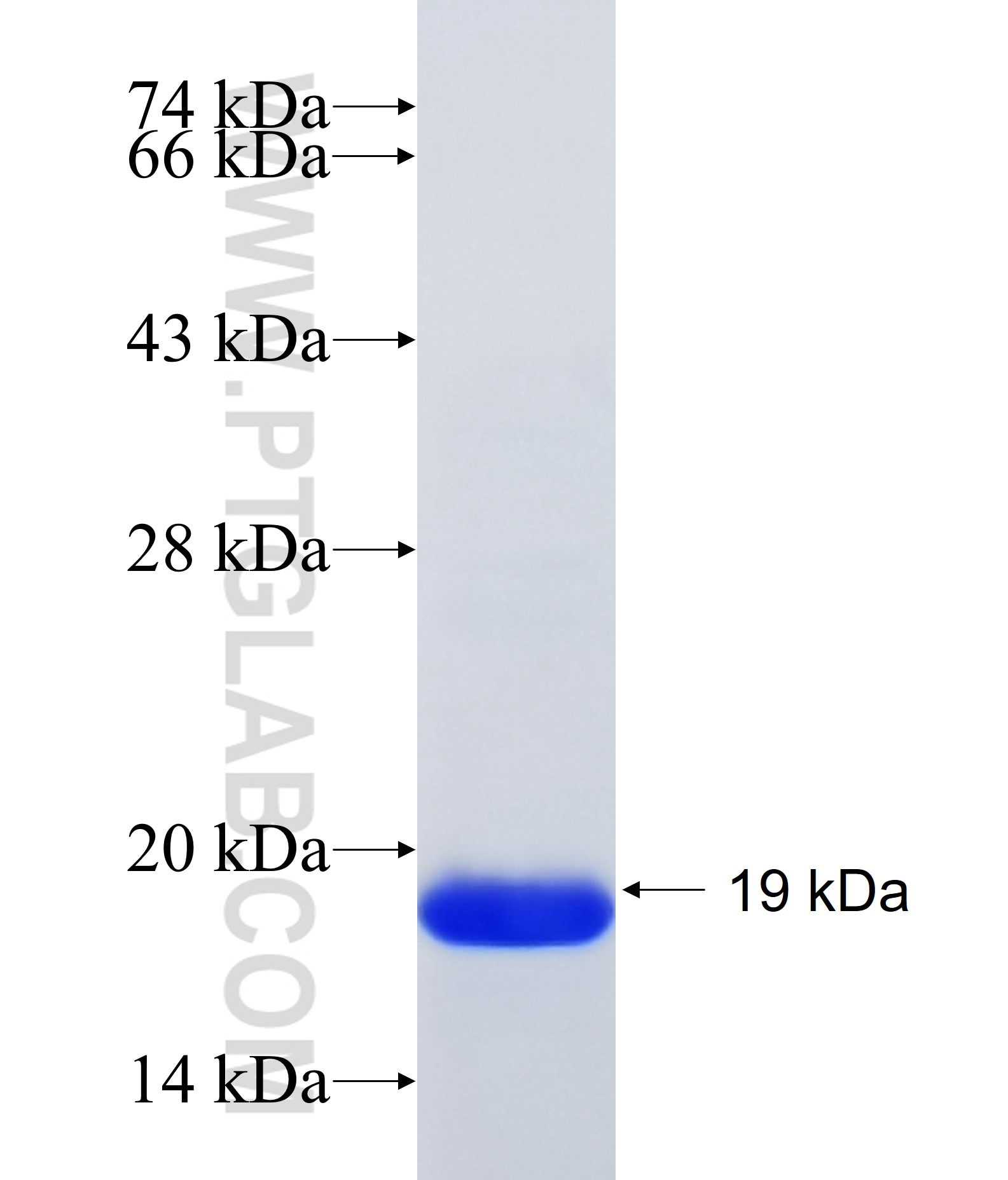 RABIF fusion protein Ag35096 SDS-PAGE RABIF fusion protein Ag35096 SDS-PAGE