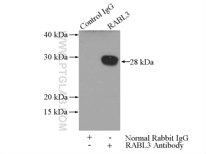 IP experiment of mouse lung using 11916-1-AP