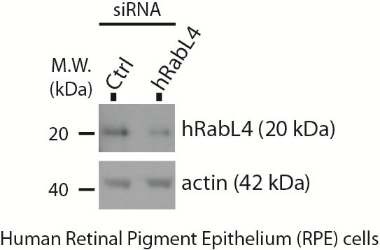 WB analysis of human RPE cells using 15017-1-AP