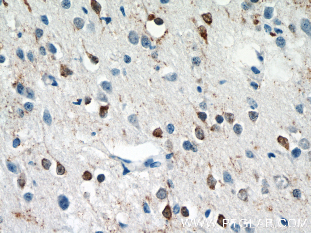 IHC staining of human brain using 15017-1-AP
