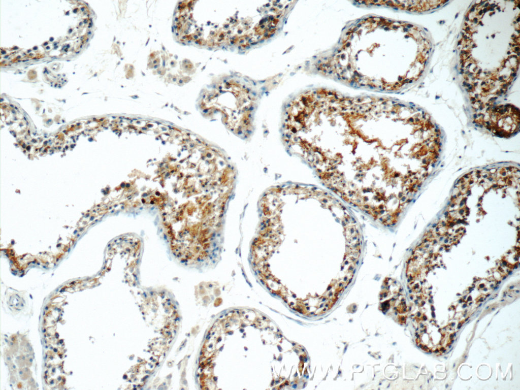 IHC staining of human testis using 15017-1-AP