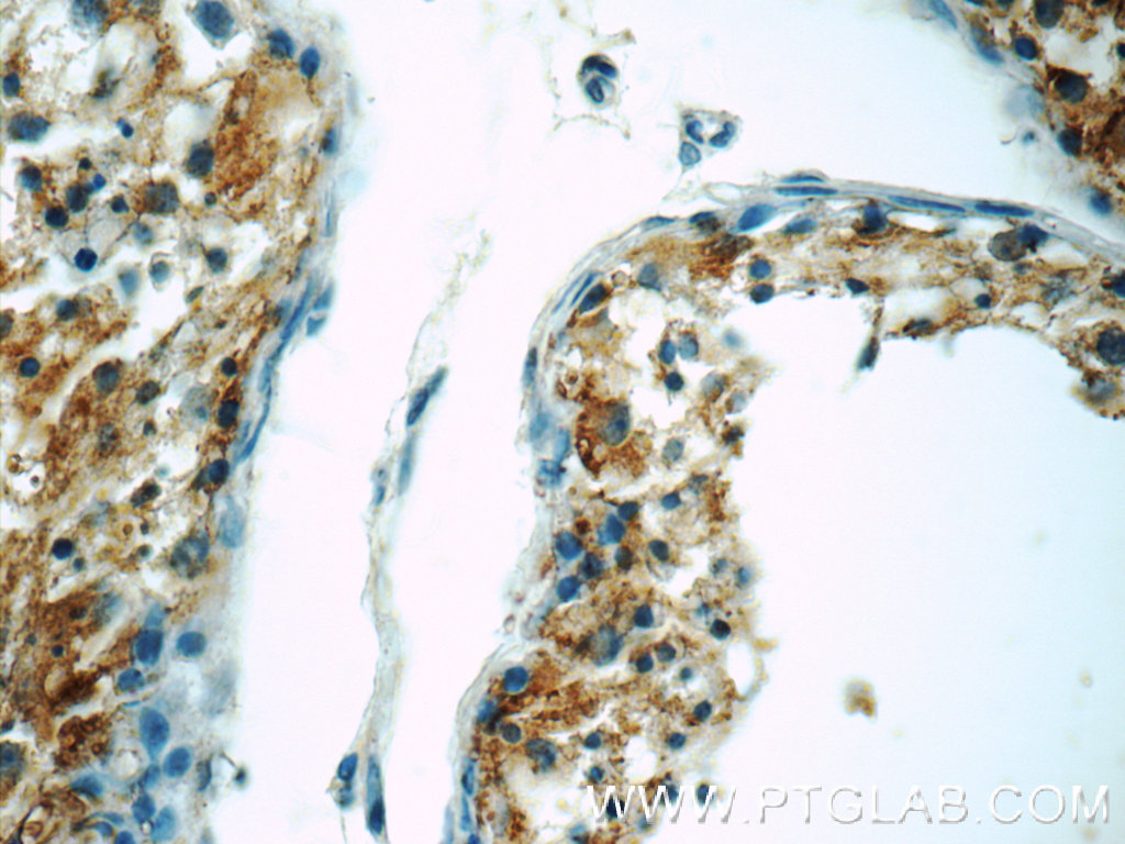 IHC staining of human testis using 15017-1-AP