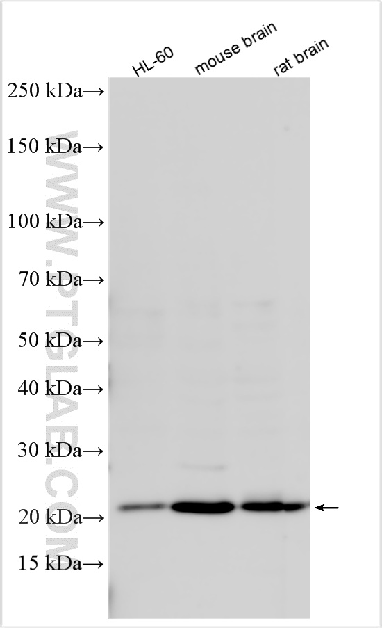 WB analysis using 24072-1-AP WB analysis using 24072-1-AP
