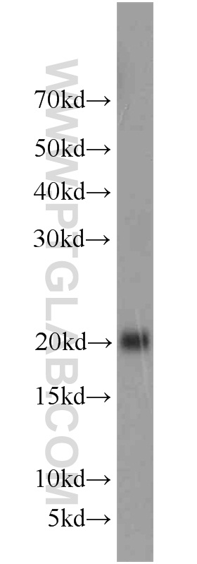 Rac1 Polyclonal antibody