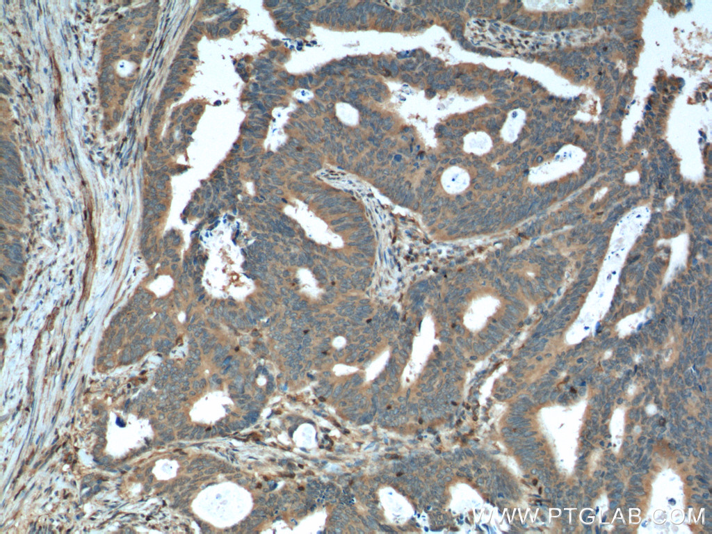 RAC1 Monoclonal antibody