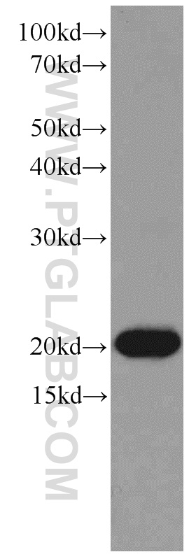 RAC1 Monoclonal antibody