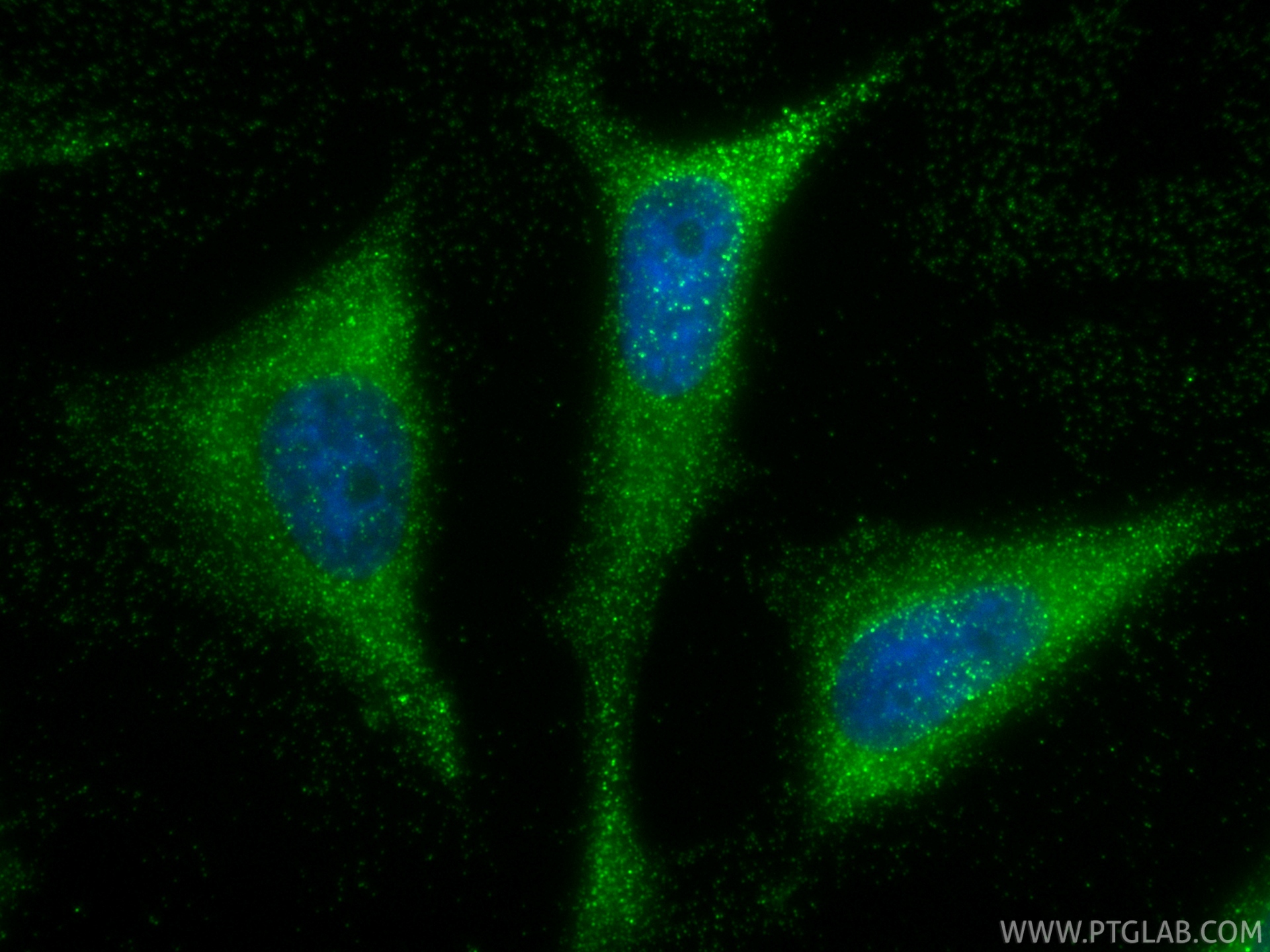 IF Staining of HeLa using 88471-1-RR