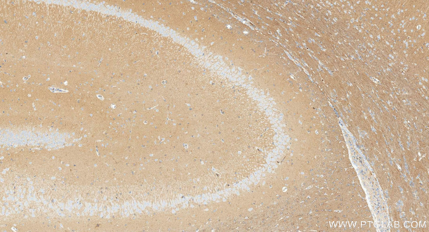 IHC staining of rat brain using 88471-1-RR