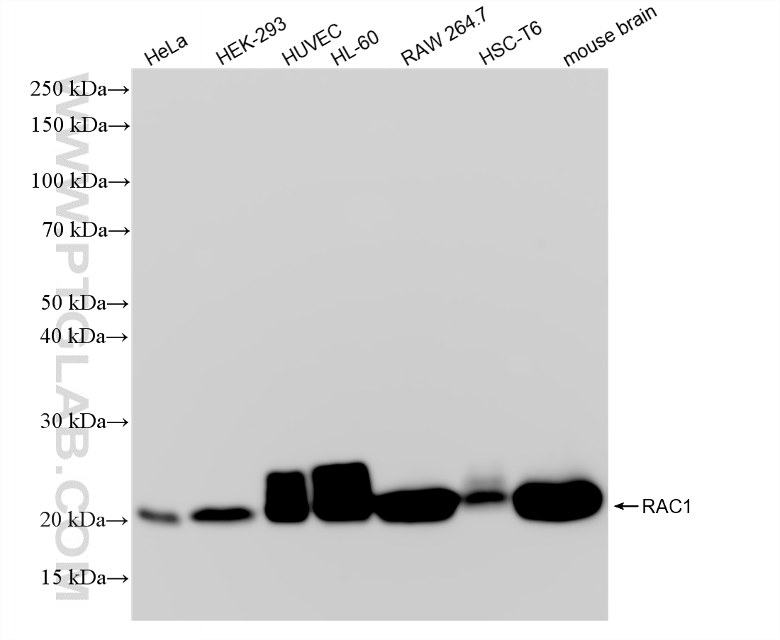 WB analysis using 88471-1-RR