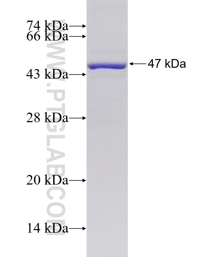 RAC2 fusion protein Ag1202 SDS-PAGE