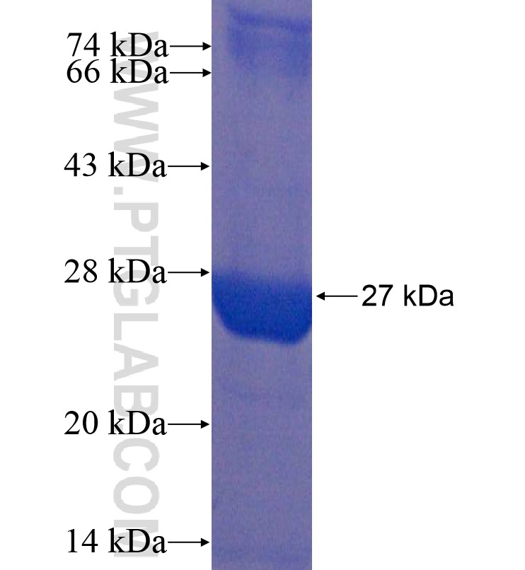 RAC2 fusion protein Ag16663 SDS-PAGE RAC2 fusion protein Ag16663 SDS-PAGE