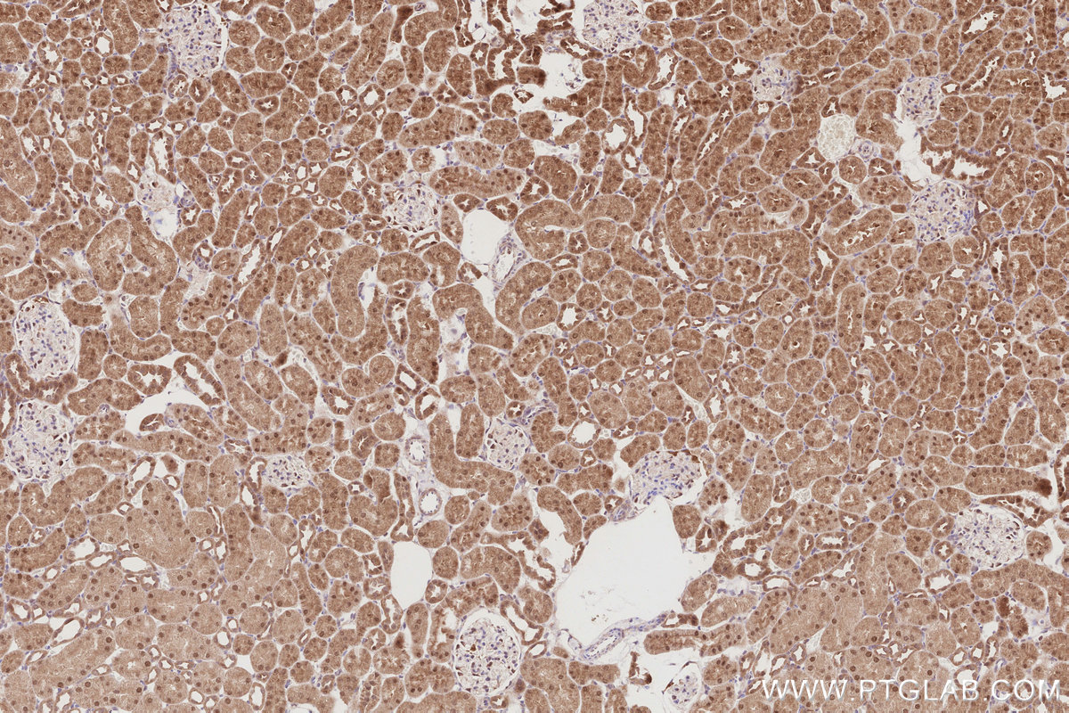 IHC staining of rat kidney using 30042-1-AP IHC staining of rat kidney using 30042-1-AP