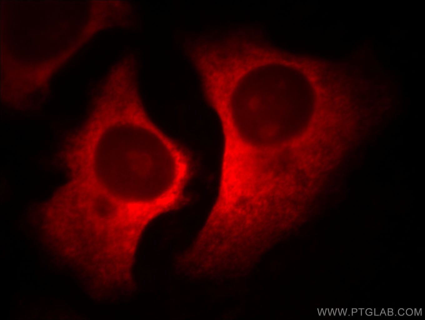 IF Staining of HeLa using 66056-1-Ig (same clone as 66056-1-PBS)