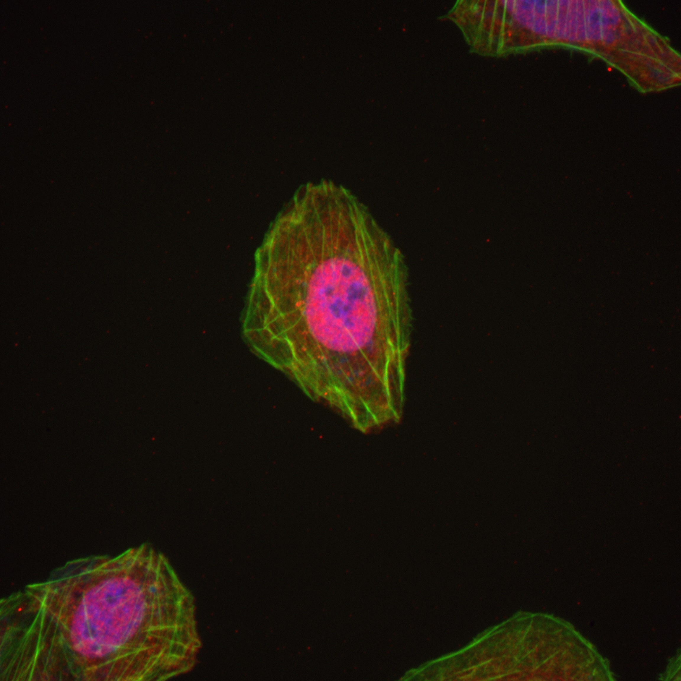 IF Staining of U2OS using 82788-1-RR (same clone as 82788-1-PBS)