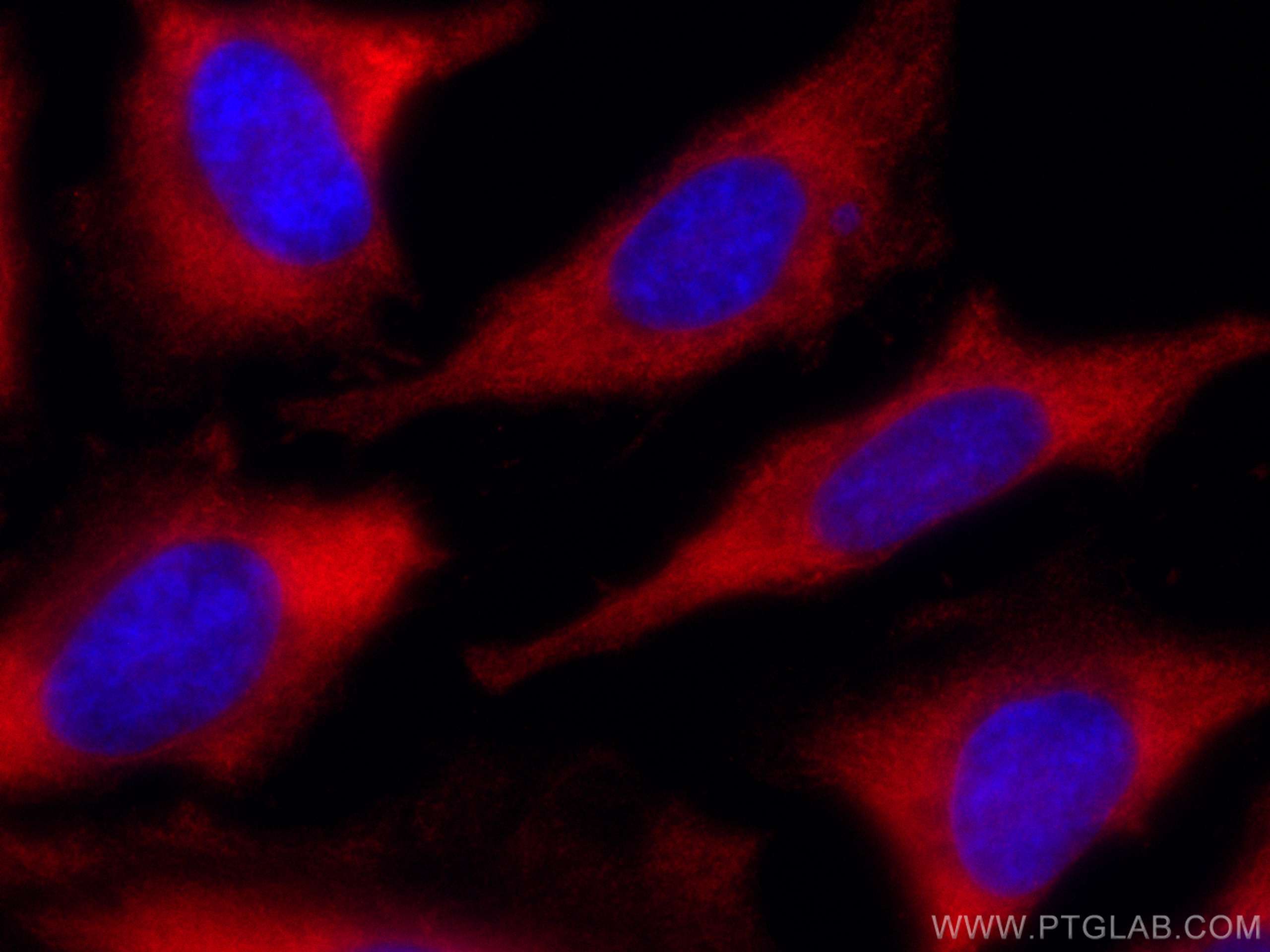 IF Staining of HeLa using CL594-66940