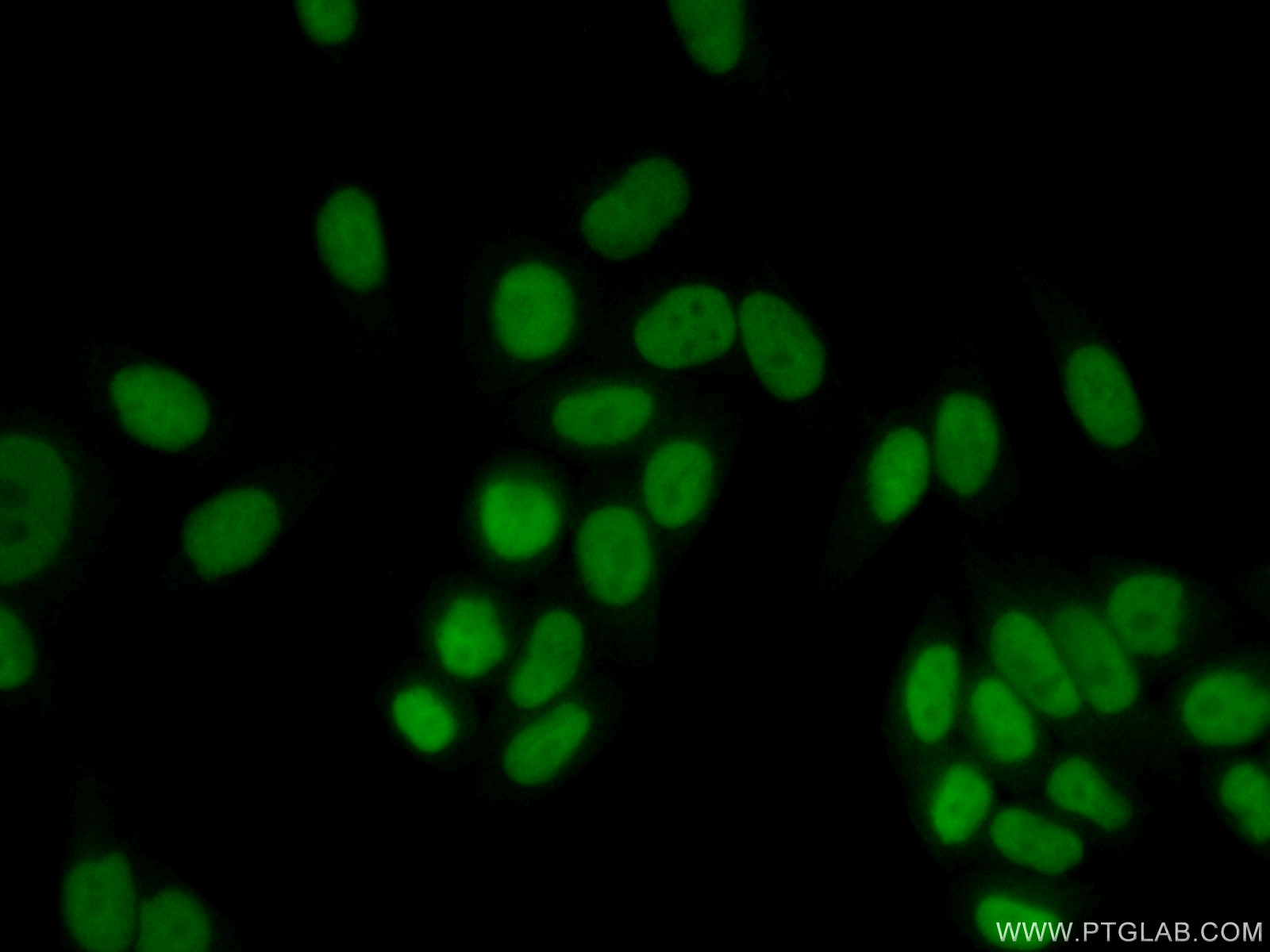 IF Staining of HeLa using 11726-2-AP