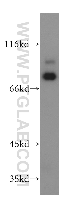 WB analysis of K-562 using 18333-1-AP