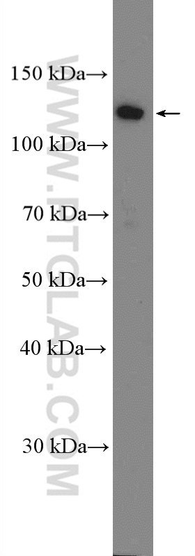 WB analysis of A549 using 27071-1-AP