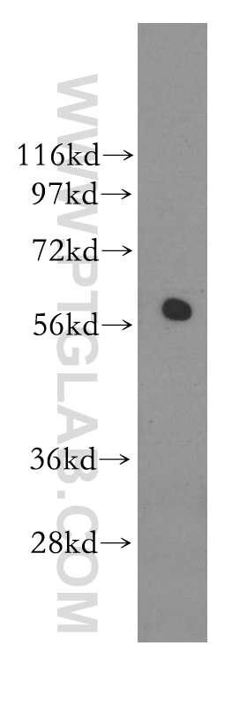 WB analysis of mouse testis using 11364-1-AP