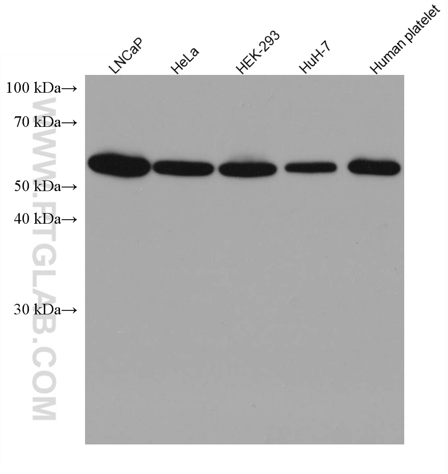 WB analysis using 67988-1-Ig