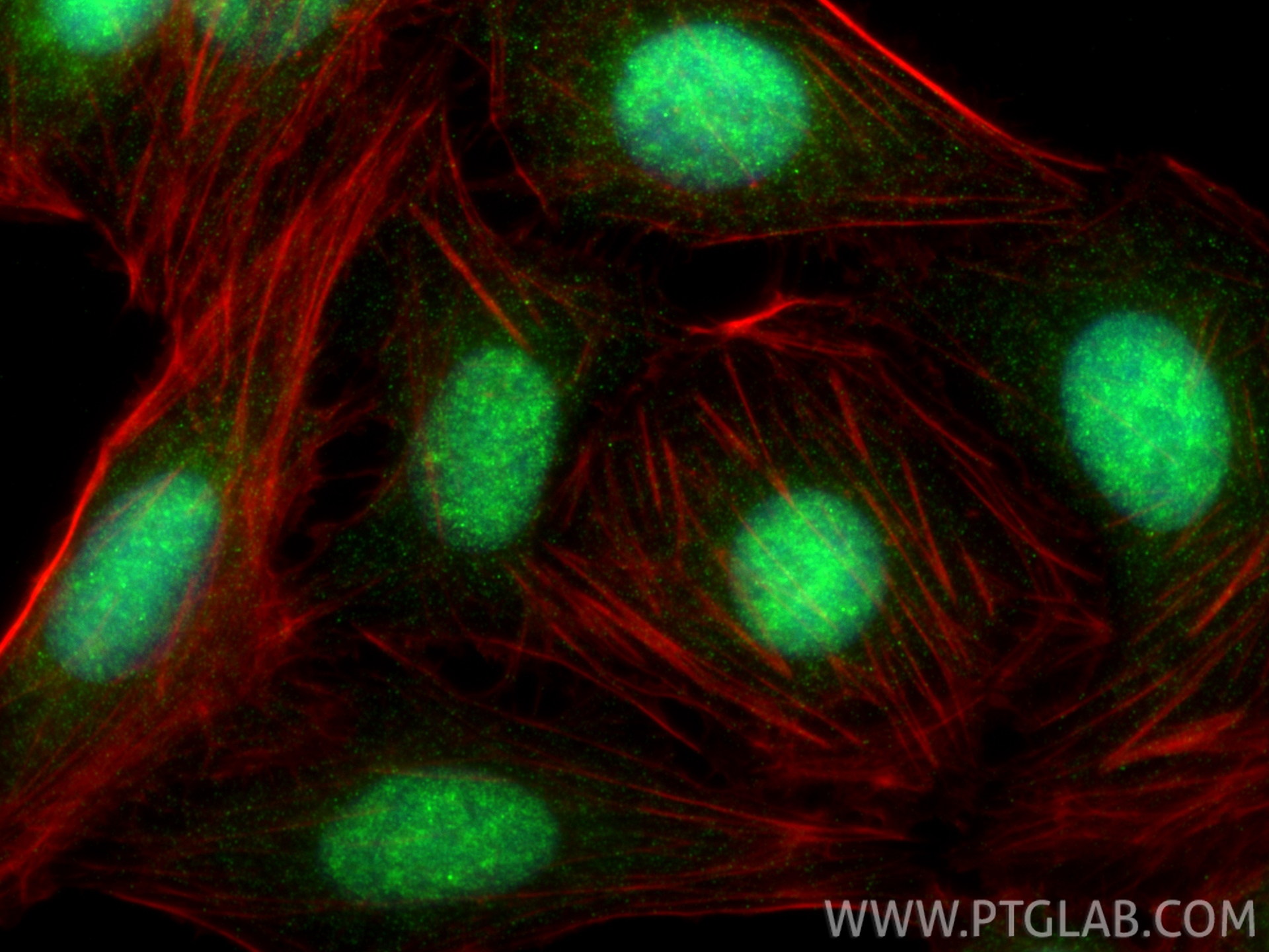 Immunofluorescent analysis of (4% PFA) fixed U2OS cells using RAD50 antibody (29390-1-AP) at dilution of 1:400 and CoraLite®488-Conjugated Goat Anti-Rabbit IgG(H+L) (<a class='green' href='/productredirect?CatalogNo=SA00013-2' target='_blank'>SA00013-2</a>), CL594-phalloidin (red). IF Staining of U2OS using 29390-1-AP