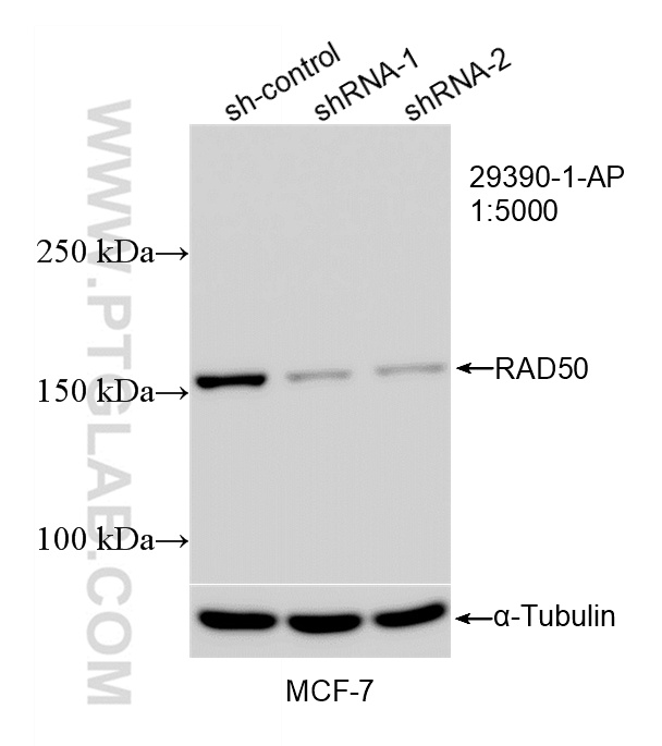 WB result of RAD50 antibody (29390-1-AP; 1:5000; incubated at room temperature for 1.5 hours) with sh-Control and sh-RAD50 transfected MCF-7 cells. WB analysis of MCF-7 using 29390-1-AP