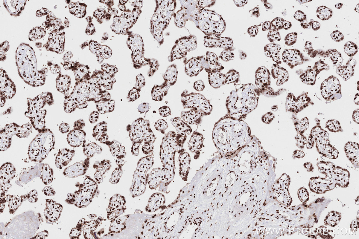 IHC staining of human placenta using 84969-4-RR (same clone as 84969-4-PBS)