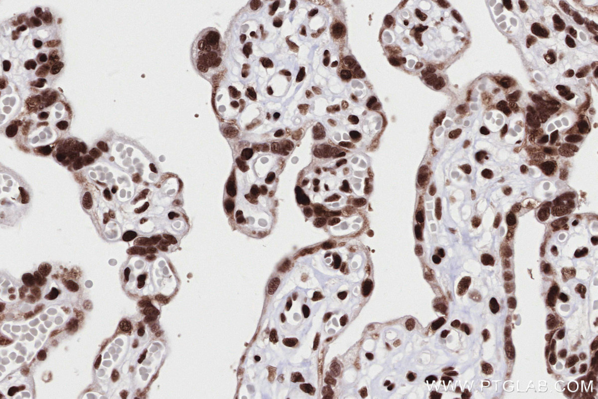 IHC staining of human placenta using 84969-4-RR (same clone as 84969-4-PBS)